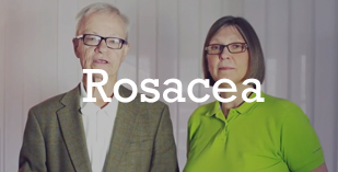 Rosacea