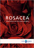 Rosacea – informasjon om et problem for voksne