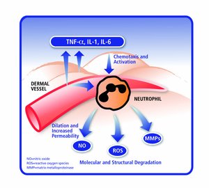 inflammationsprocessen